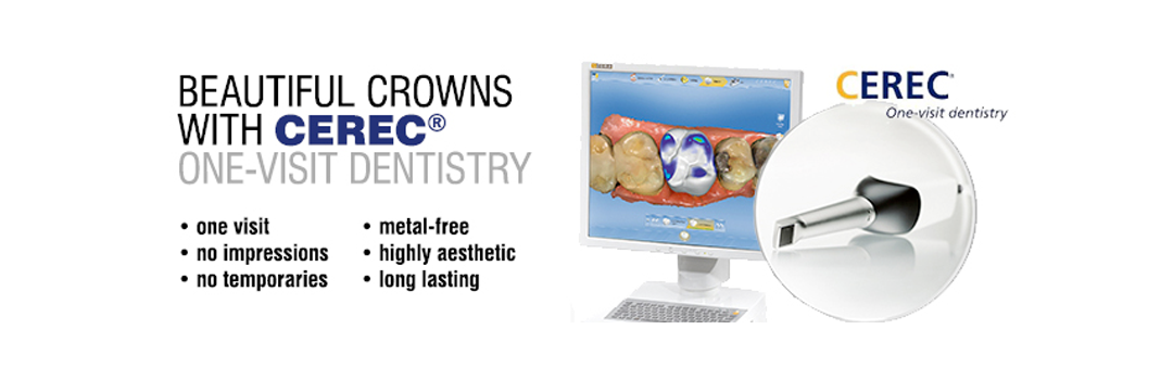 Crowns with Cerec from your Knoxville Dentist