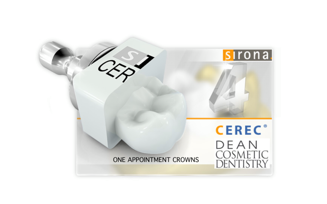 Cerec Crowns @ Dean Cosmetic Dentistry