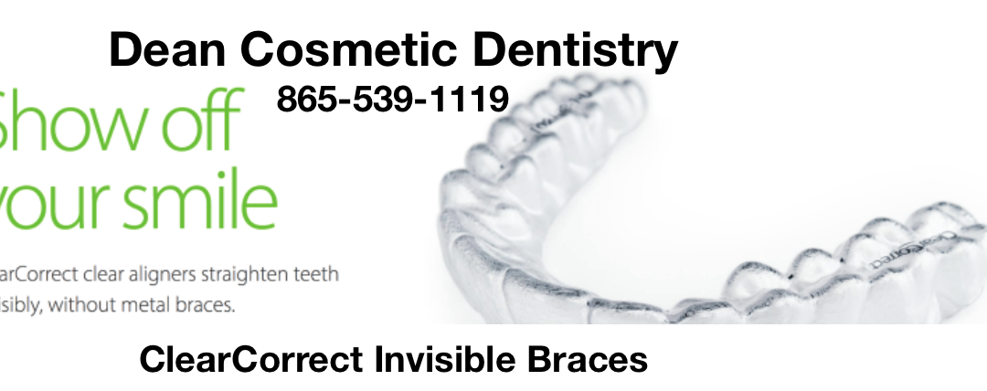 ClearCorrect is the invisible way to straighten teeth without braces