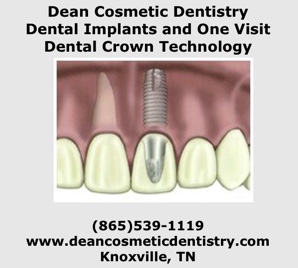 Dean Cosmetic Dentistry Offers Advanced Dental Implants & Restorations