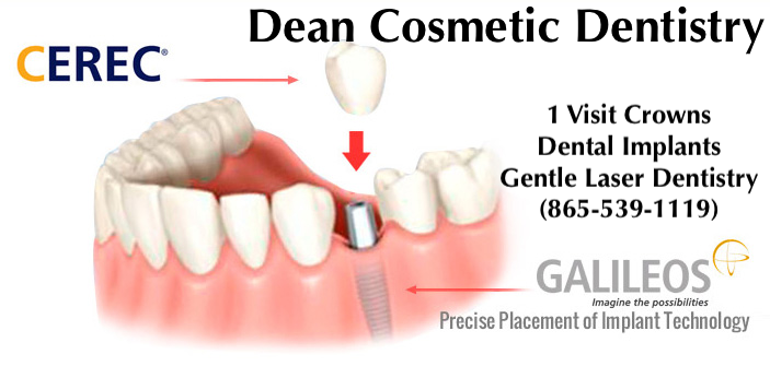 Get Back Your Smile At Dean Cosmetic Dentistry