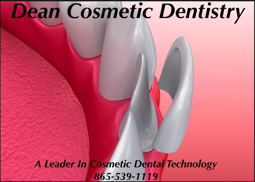Dean Cosmetic Dentistry Veneers